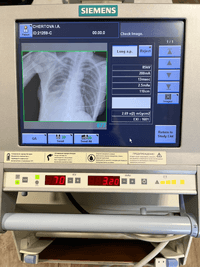 Рентген мобильный Siemens MOBILETT XP Digital