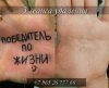 Б/У Неодимовый Nd:YAG лазер для удаления тату KES MED 810A + ОБУЧЕНИЕ БЕСПЛАТНО!