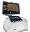 УЗИ GE Voluson E10