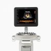 УЗИ сканер Philips Clearvue 550