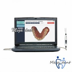 Интраоральный сканер Condor