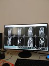 МРТ Esaote G-Scan Brio