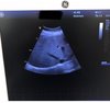 УЗИ GE Healthcare Vivid T8