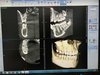 Томограф Planmeca ProMax 3D Classic