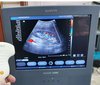УЗИ аппарат Siemens Acuson X300 PE