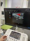 Аппарат ультрозвуковой диагностики MyLab X6