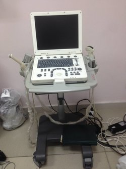 УЗИ MySono U5