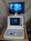 УЗИ сканер GE Logiq 100 Pro c конвексным, линейным и внутриполостным датчиками