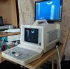 УЗИ сканер GE Logiq 100 Pro c конвексным, линейным и внутриполостным датчиками