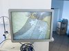 Эндоскопический набор Olympus 190 Процессор Olympus Visera Elite OTV-S190
