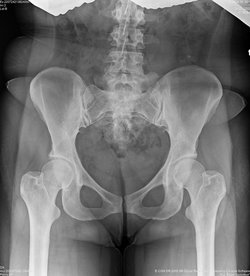 Плоскопанельный рентгеновский детектор, DR-панель 