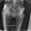 Плоскопанельный рентгеновский детектор, DR-панель 