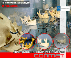 Копрессинно-дистракционные устройства (КДУ)