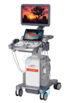 УЗИ Siemens Acuson Juniper