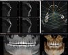 Дентальный томограф Rayscan Symphony Alpha 3D