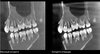 Дентальный томограф Rayscan Symphony Alpha 3D
