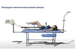 Аппарат "Ормед тракцион"