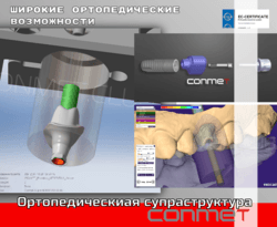 Цифровые модели и аналоги имплантатов КОНМЕТ!