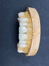 Циркониевые диски Zirdent 3D Pro Multilayer
