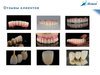 Циркониевые диски Zirdent 3D Pro Multilayer