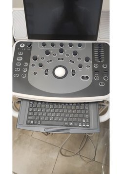 УЗИ DC-70 Pro X-insight