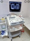 Стационарная цветная цифровая ультразвуковая диагностическая система SSI-5500 SonoScape б/у