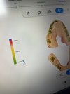 Интраоральный сканер Shining 3D Aoralscan 3