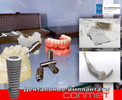Дентальные имплантаты КОНМЕТ