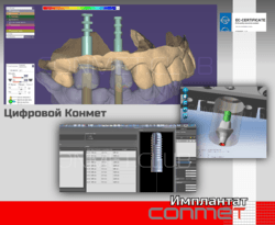 Цифровой Конмет