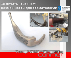 3D печать титаном - возможности для стоматологии!