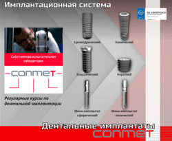 Ассортимент имплантатов КОНМЕТ!