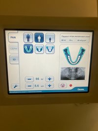 GXDP 700 3D Цифровая панорамная система с функцией 3D томографии