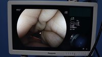 Эндоскопическая система FUJIFILM (Fujinon) LASEREO 7000