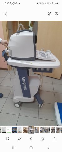 Узи сканер миндрей