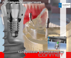 Российская дентальная система с цифровыми возможностями! 