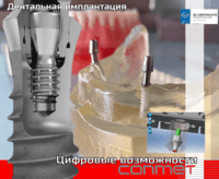 Российская дентальная система с цифровыми возможностями! 
