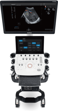 Узи аппарат SonoScape P25 Elite V