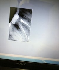 Дентальный рентген Preva Dental x ray system