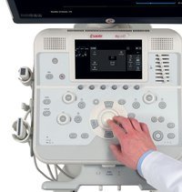 Аппарат УЗИ MyLab X6