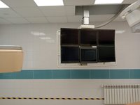 Ангиограф Philips Allura Хper FD 10 (Ангиографическая система Филипс Алюра)