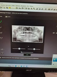 Ортопантомограф KAVO OP 3D