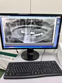 Ортопантомограф Sirona ORTHOPHOS XG 3D Ready