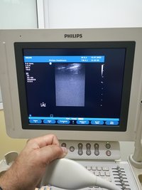 УЗИ аппарат PHILIPS HD11XE, 2011 г.в.
