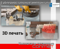 Субпериостальные имплантаты КОНМЕТ