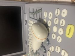 Портативный 4D аппарат SIUI Apogee 1100