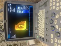Портативный 4D аппарат SIUI Apogee 1100
