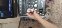 УЗИ аппарат Alpinion E-cube 9 Diamond, отличное состояние