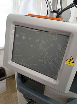 Аппарат медицинский лазерный "СмартКсайд2" SmartXide2 с принадлежностями