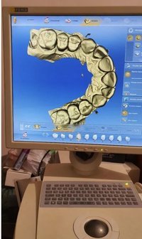 Интраоральный сканер Sirona Cerec Bluecam