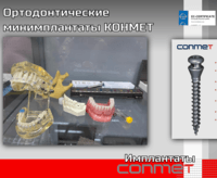 Ортодонтические минимплантаты КОНМЕТ
